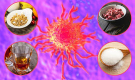 Kaip nesusirgti vėžiu? Įsiminkite 4 taisykles  