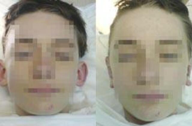 Atlėpusių ausų klijuoti neverta 