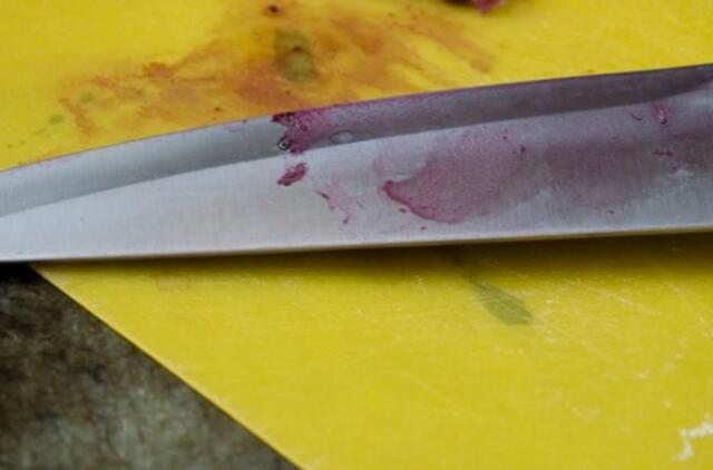 Neblaivi moteris vyrą sužalojo peiliu