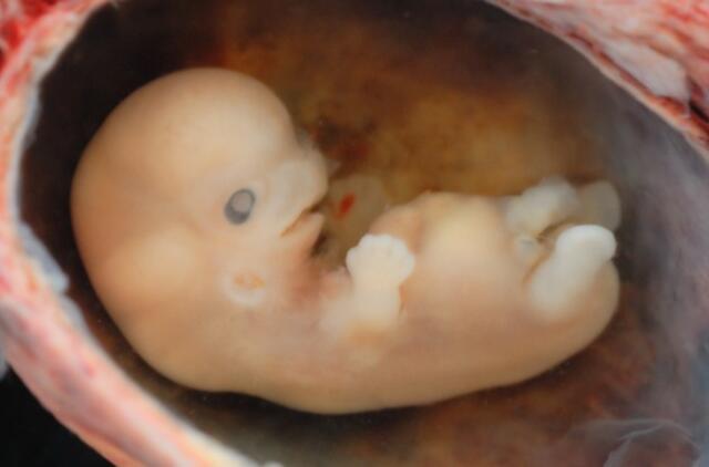 Seime - ginčai dėl lytinių ląstelių donorystės ir embrionų šaldymo