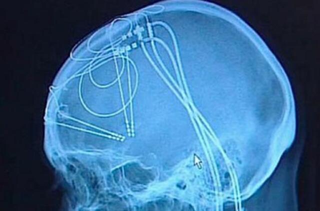 Britei pavyko visiškai panaikinti gilią depresiją