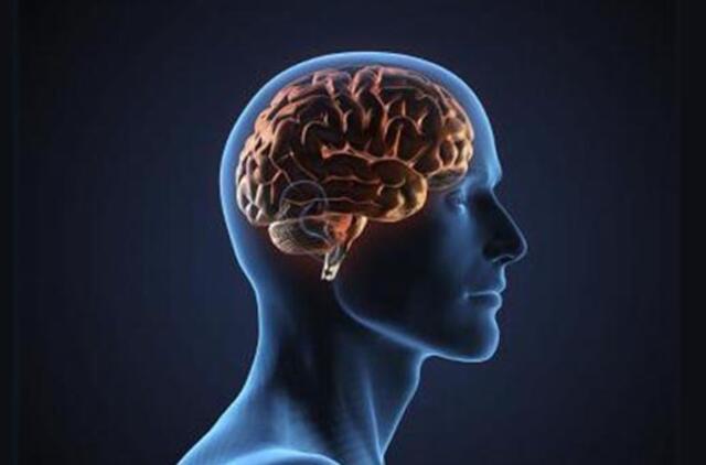 Klausimas specialistui