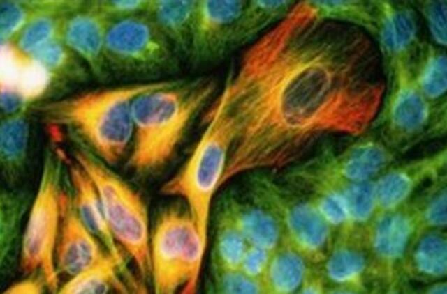 Atrasti nauji veiksmingesni vaistai nuo odos vėžio