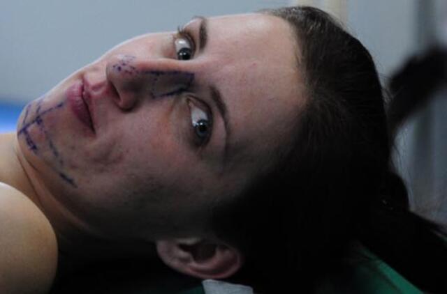 Kompleksų atsikratyti pasiryžusios merginos išsižadėjo tėvas