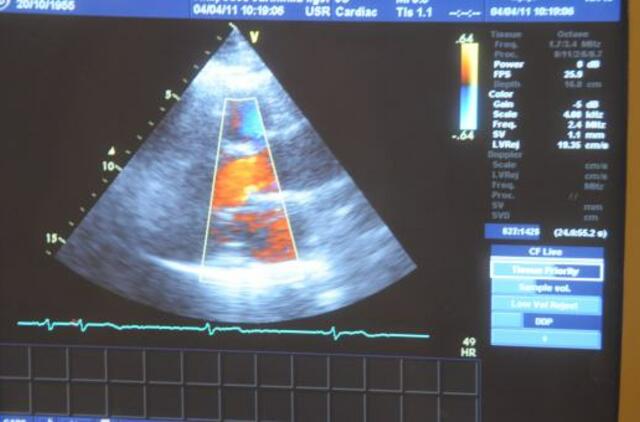 Trejų metų berniuko gyvybę dirbtinė širdis palaikė 251 dieną