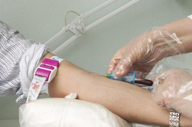 Mokslininkai atrado mįslingą ligą, kurios simptomai panašūs į AIDS