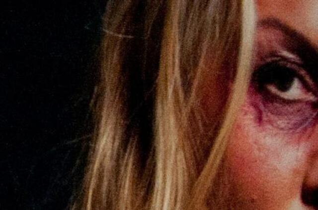 Klaipėdietė nubausta už smūgį kaimynei