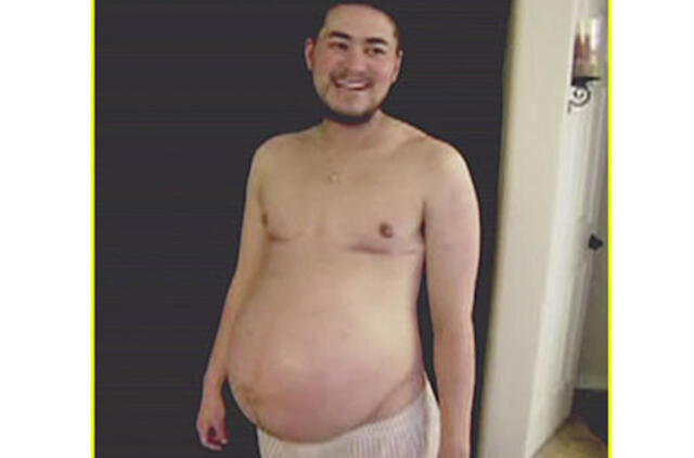 Nėščias vyras pasinaudojo lietuvio sperma