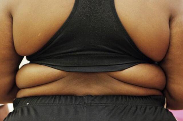 Vyrai Lietuvoje vis labiau kamuojami antsvorio problemų