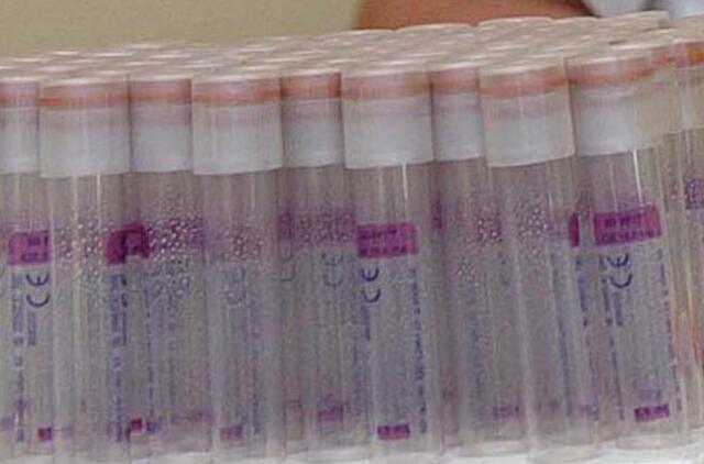 Nuolatos prastėja prancūzų sperma