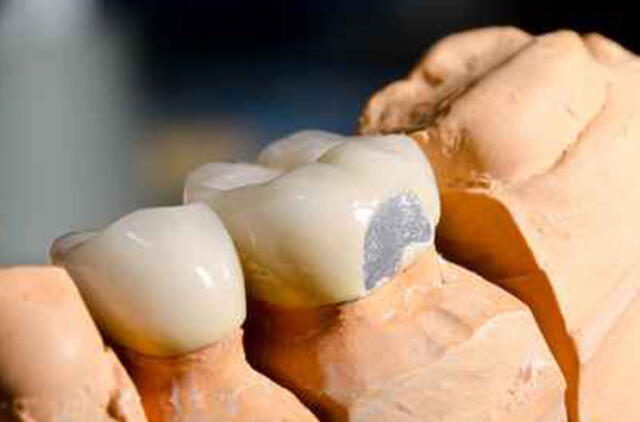 Vokietijos teismas atėmė licenciją iš stomatologo, kuris be priežasties pacientui išrovė beveik visus dantis