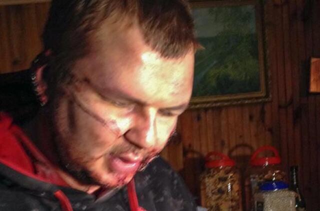 "Automaidano" lyderis Dmitro Bulatovas: mane mušė kiekvieną dieną