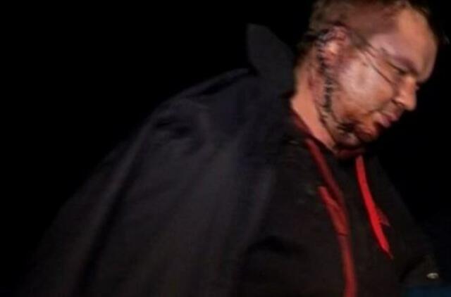 Dmitro Bulatovas atskrido gydytis į Vilnių