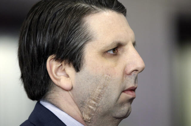 JAV pasiuntinį Pietų Korėjoje užpuolusiam vyrui pareikšti kaltinimai