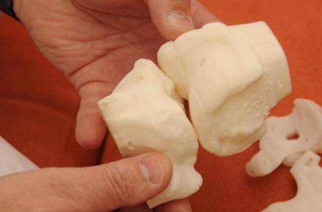 Antikorupcijos komisija kreipėsi į Generalinę prokuratūrą dėl ortopedijos priemonių