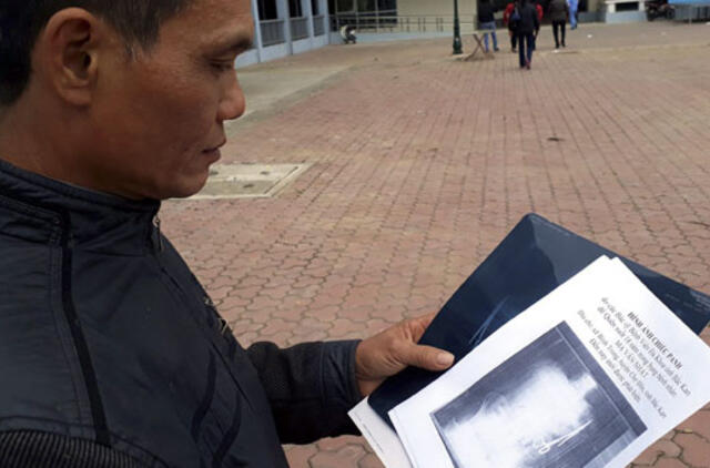 Vietnamietis 18 metų gyveno su chirurginėmis žirklėmis pilve