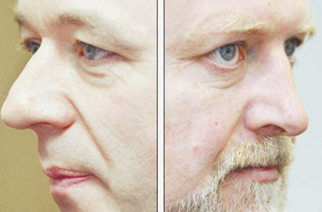 Gavo valdžią - išvertė kailį