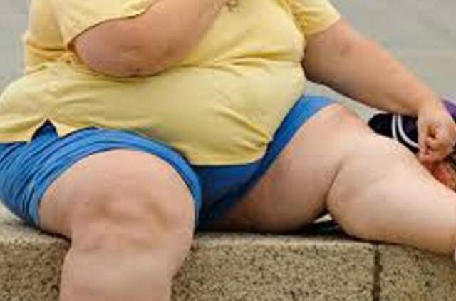 Nutukę žmonės skonį jaučia silpniau