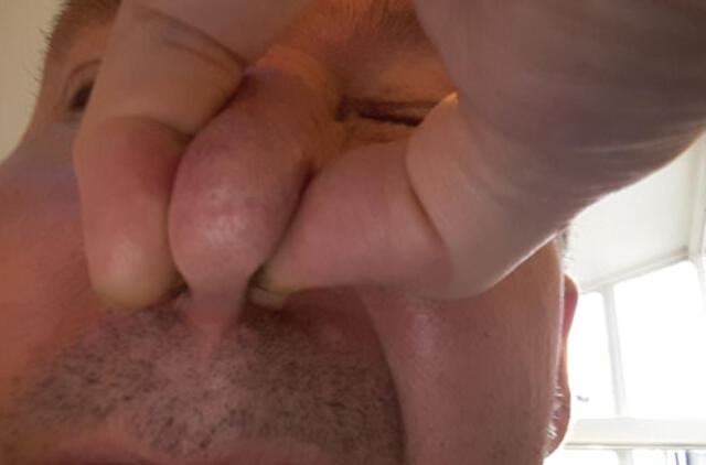 Kvapų ir taršos problemas spręs kartu