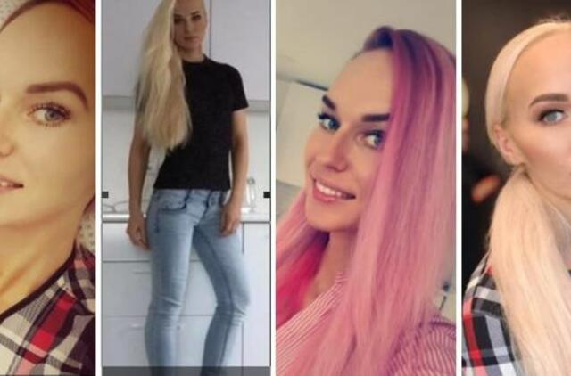 Krūtinę pasididinusi Gražulio Birutė sulaukė kritikos lavinos: užsiauginau storą odą