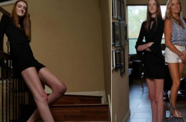 Paauglė iš Teksaso – ilgiausių pasaulyje kojų savininkė: pagerino du Gineso rekordus