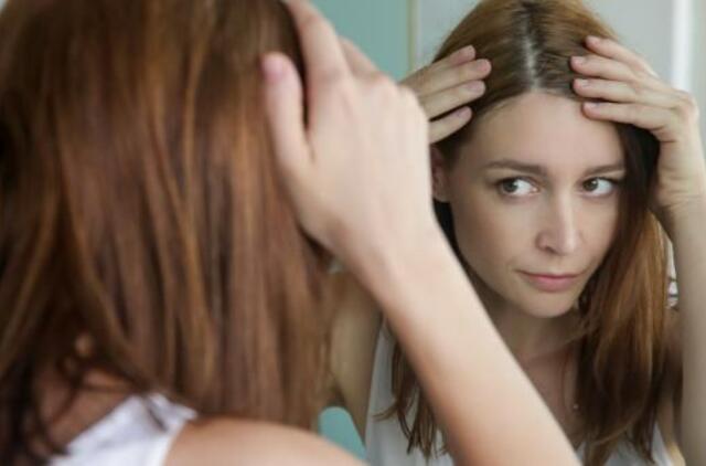 Pleiskanos - kada vertėtų sunerimti?