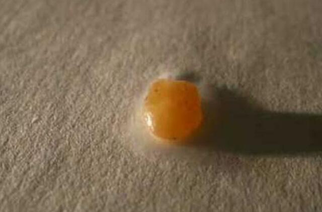 Gintarų rinkimas tik per plauką nesibaigė tragedija