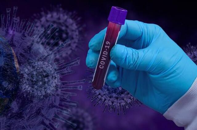 Preliminarūs duomenys: 2270 naujų COVID-19 atvejų