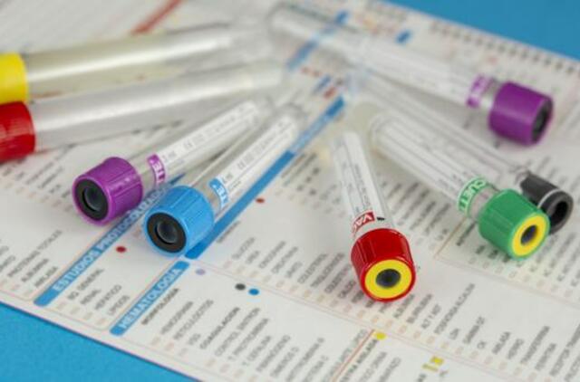 Retas kraujo vėžys smogia patyliukais