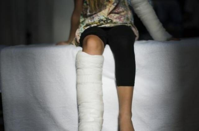 Vaikas susižeidė žaisdamas. Kodėl tėvus aplanko vaiko teisių apsaugos specialistas?