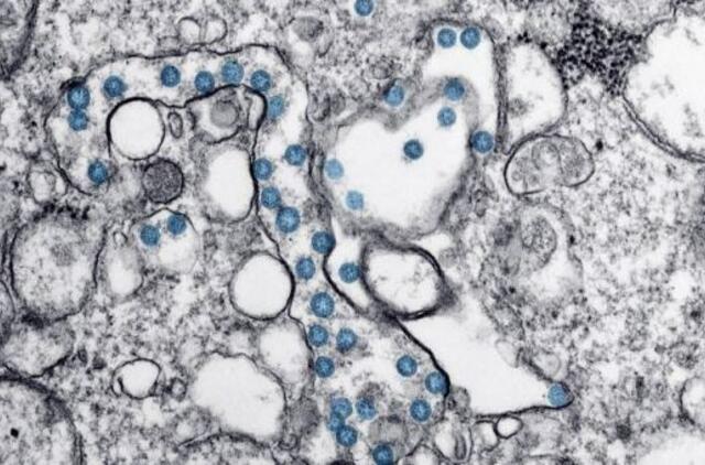 VU mokslininkai: antikūnai prieš koronavirusą išlieka pusę metų