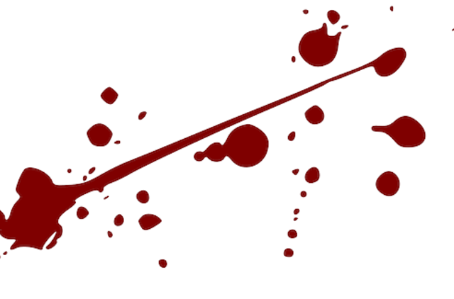 Kraujavimas iš nosies vargina dėl sauso oro, vaistų ir įvairių ligų